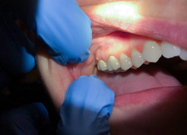Best Orthodontic Emergency Dentist in Alvord, TX